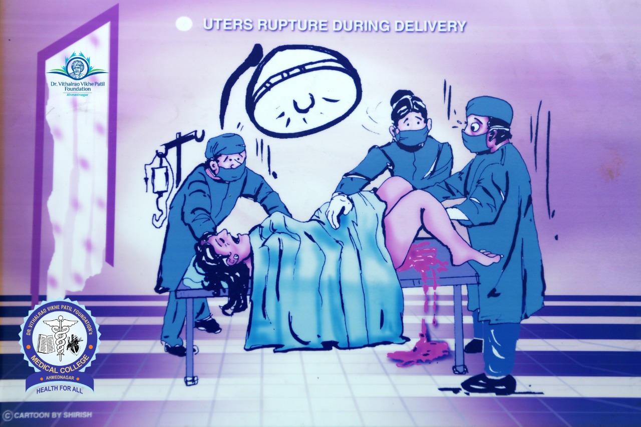 Popup Image